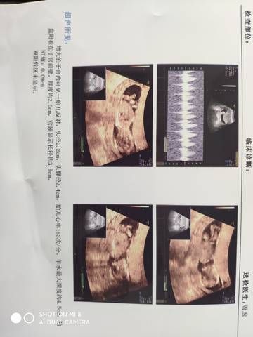 journal_insert_pic_1719409389