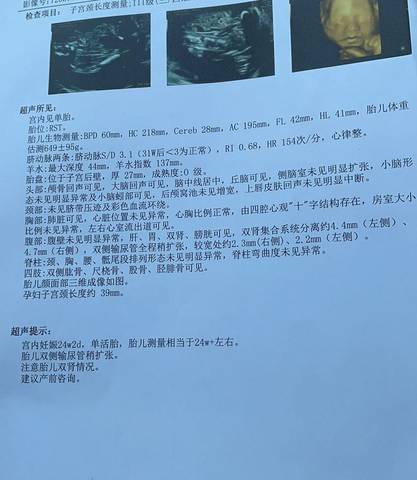 journal_insert_pic_1678260098