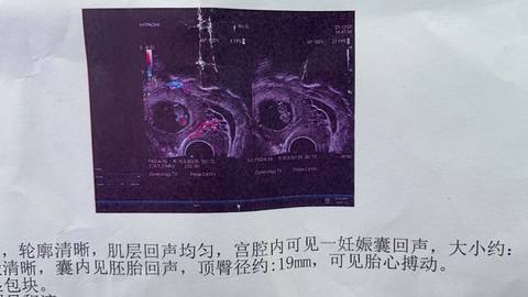 journal_insert_pic_1675689854