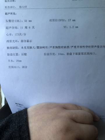 journal_insert_pic_1675564257