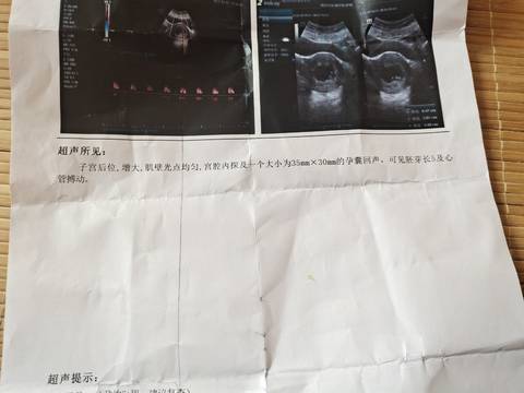 journal_insert_pic_1682056124