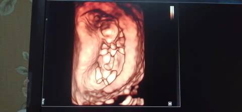 journal_insert_pic_1741080307