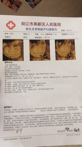journal_insert_pic_1740983645