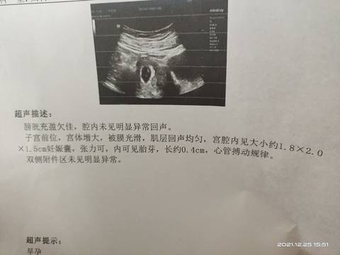 journal_insert_pic_1685904185