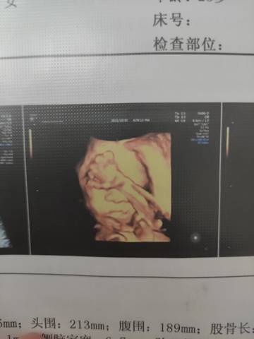 journal_insert_pic_1675304509