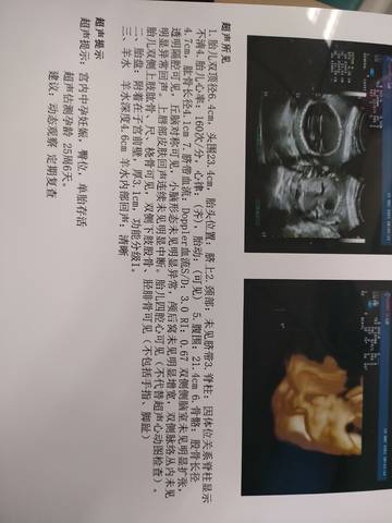 journal_insert_pic_1677352386