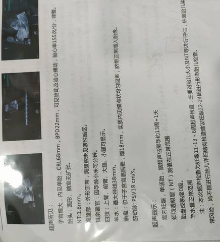 journal_insert_pic_1673162614