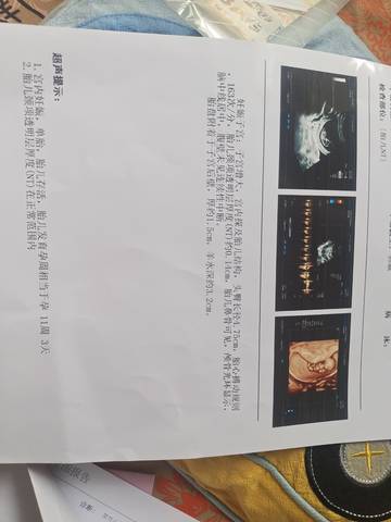 journal_insert_pic_1677376307