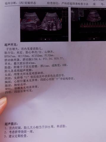journal_insert_pic_1684368179