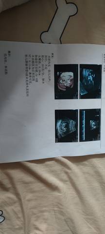 journal_insert_pic_1677421764
