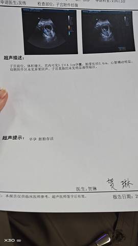 journal_insert_pic_1679556479