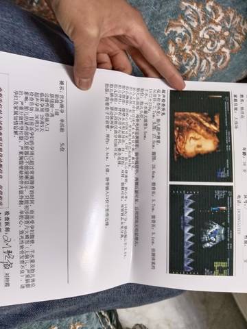journal_insert_pic_1679940599