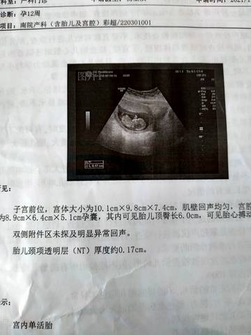 journal_insert_pic_1683584705