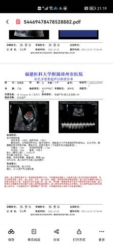 journal_insert_pic_1681028427