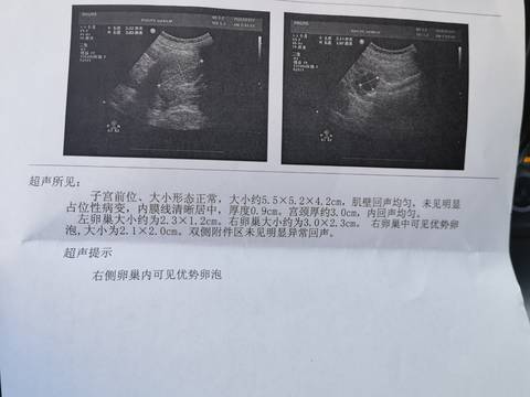 journal_insert_pic_1685708866