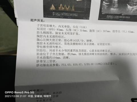 journal_insert_pic_1676336740