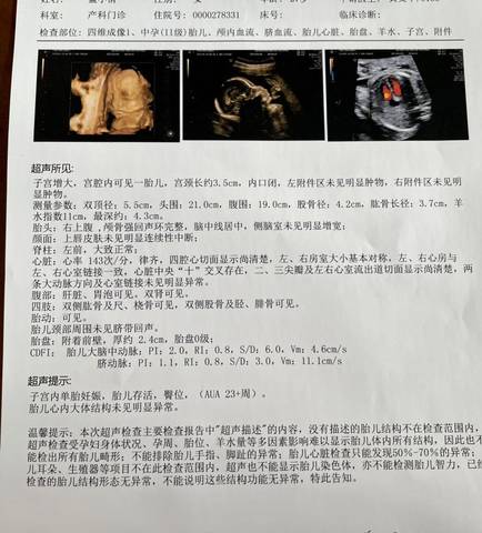 journal_insert_pic_1690270352
