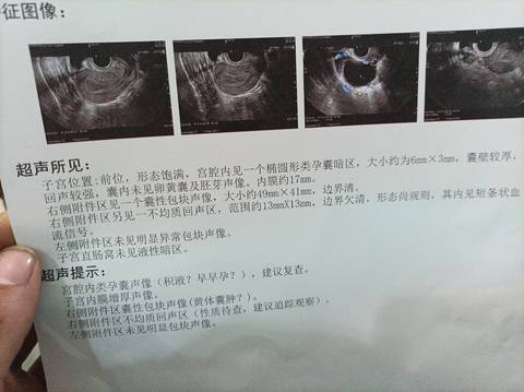 journal_insert_pic_1679536716