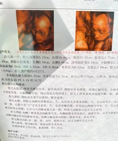 journal_insert_pic_1682709391