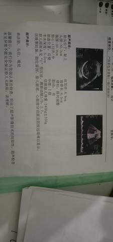 journal_insert_pic_1687290956