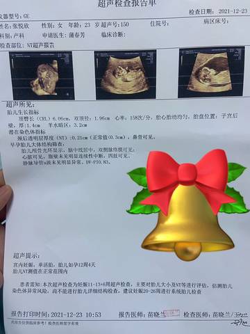 journal_insert_pic_1685025639