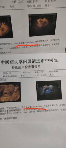 journal_insert_pic_1686604442