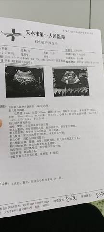 journal_insert_pic_1684169272