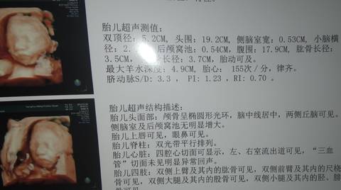 journal_insert_pic_1686424944