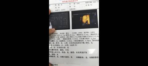 journal_insert_pic_1687486550