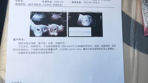 journal_insert_pic_1688986503