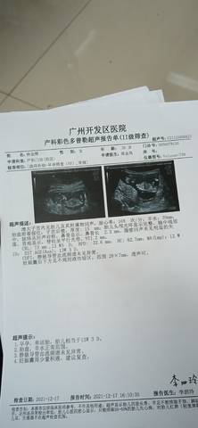 journal_insert_pic_1682351959