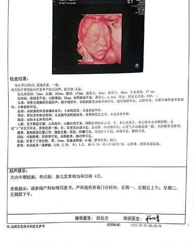 journal_insert_pic_1740923715