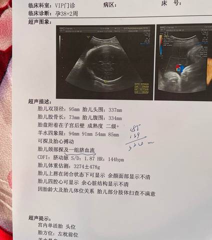 journal_insert_pic_1678306964