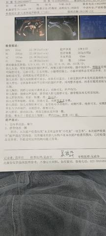 journal_insert_pic_1679557865