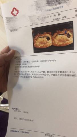 journal_insert_pic_1680149711