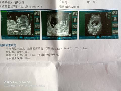 journal_insert_pic_1690118095