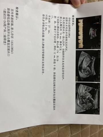journal_insert_pic_1687898688