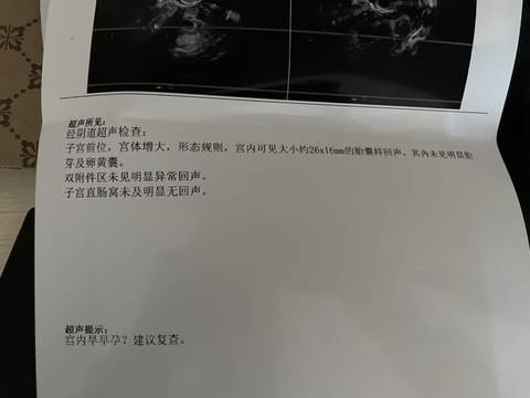 journal_insert_pic_1741046893