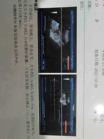 journal_insert_pic_1688468746