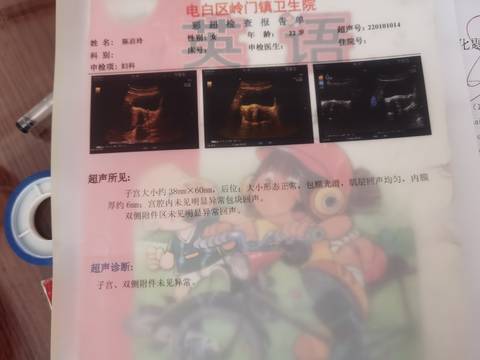 journal_insert_pic_1690225765
