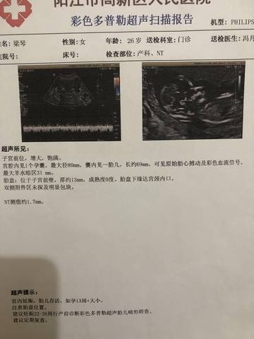 journal_insert_pic_1689135505