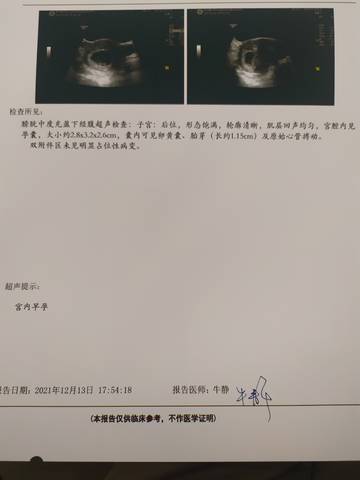 journal_insert_pic_1679214135