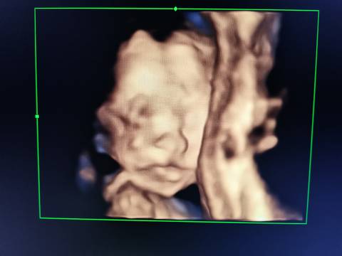 journal_insert_pic_1684206114