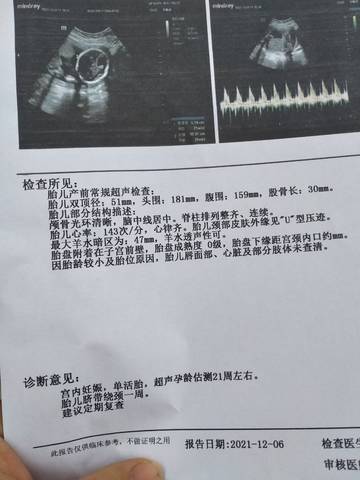 journal_insert_pic_1674740632