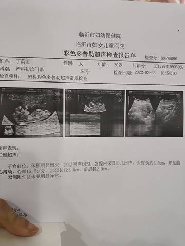 journal_insert_pic_1740828654