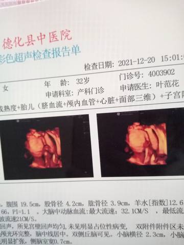 journal_insert_pic_1683211236