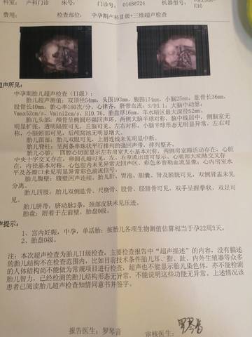 journal_insert_pic_1689449535
