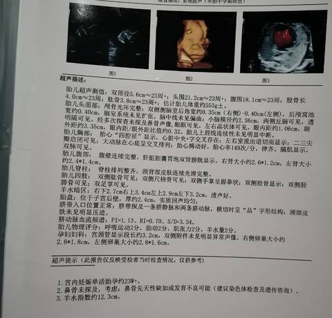 journal_insert_pic_1685596772