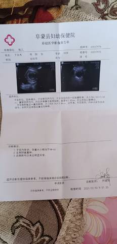 journal_insert_pic_1677350307