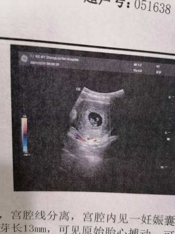 journal_insert_pic_1690386142